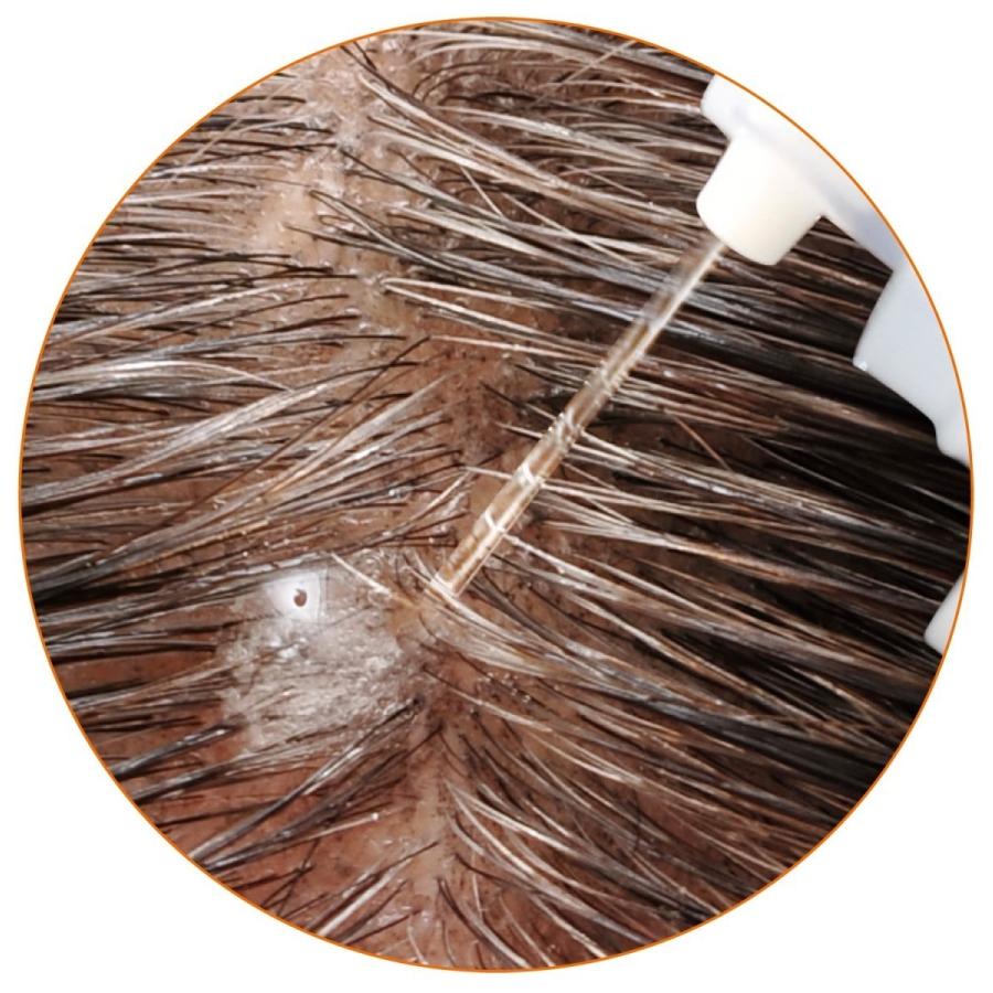 CLUEiD（クルード） 2本セット 抜け毛予防 育毛剤 女性用 60代 50代 40