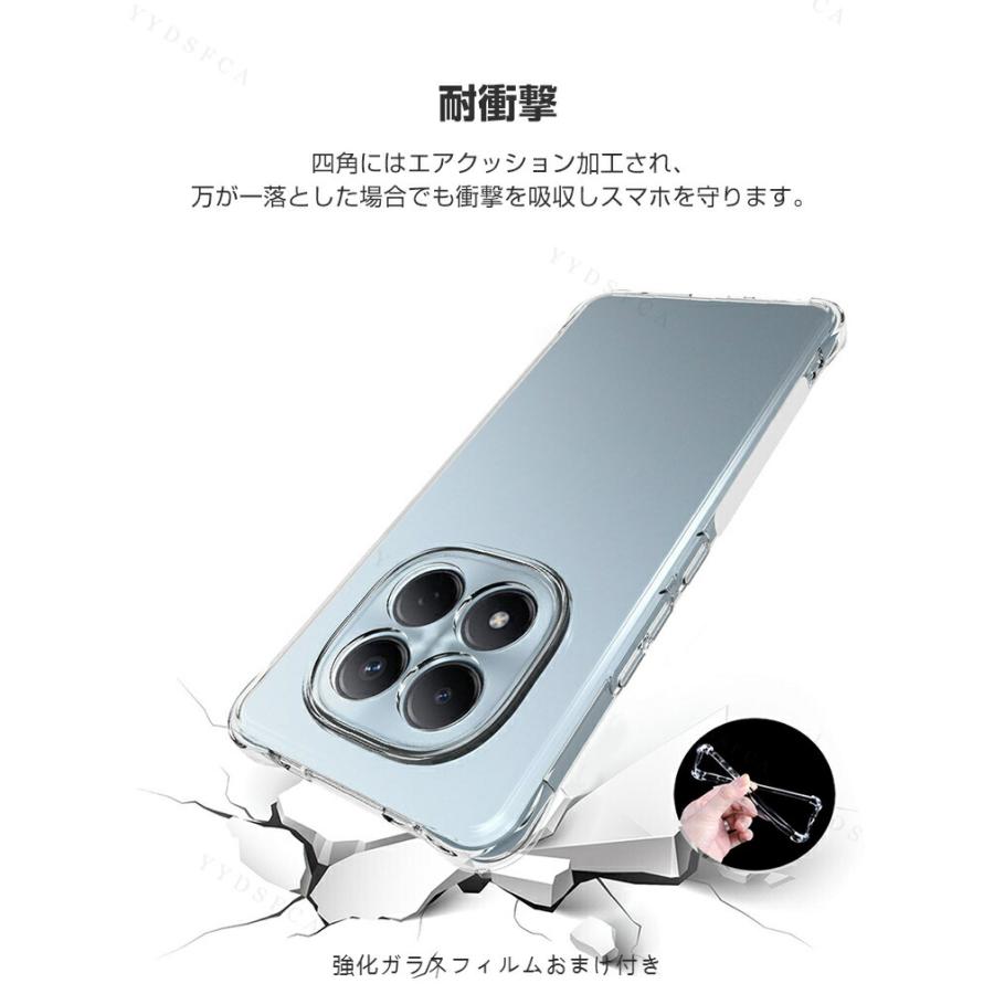 Xiaomi（シャオミ） Xiaomi REDMI Note 15/Note 15 Pro/Note 15 Pro+用
