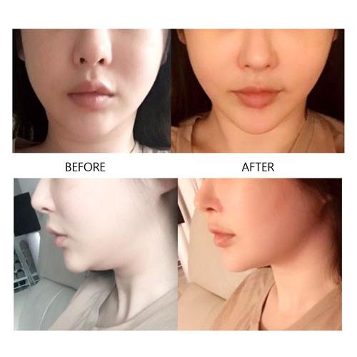 使用期限間近【韓国コスメ】Avajar パーフェクトV リフトケア