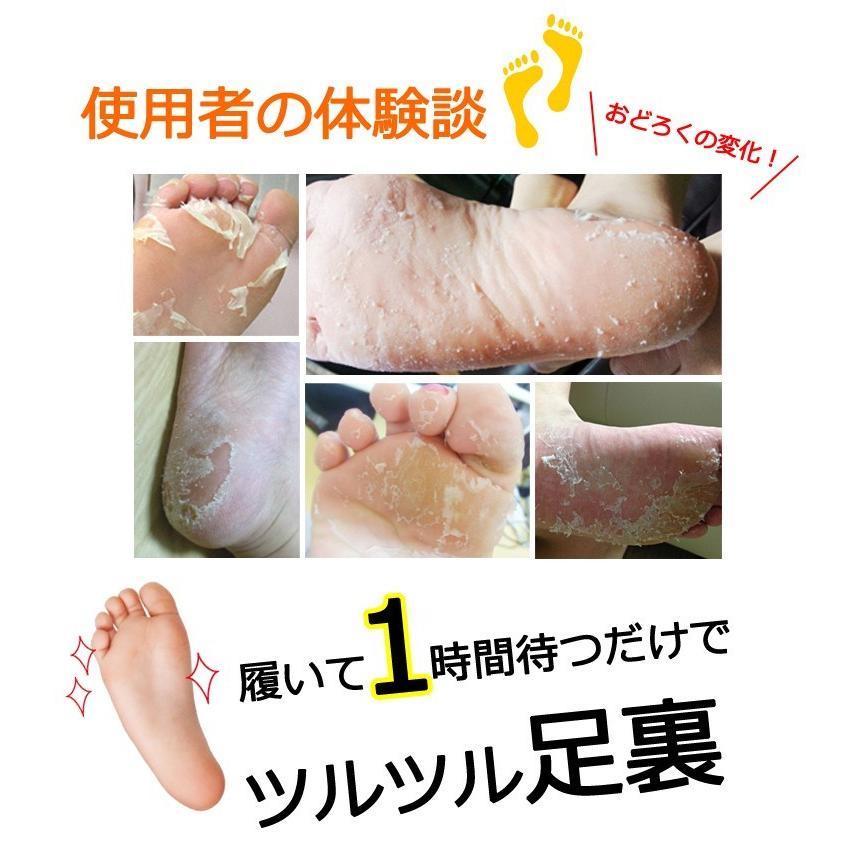 ザキュア フットピーリング パック 足裏 角質 ケア 3回分【即日