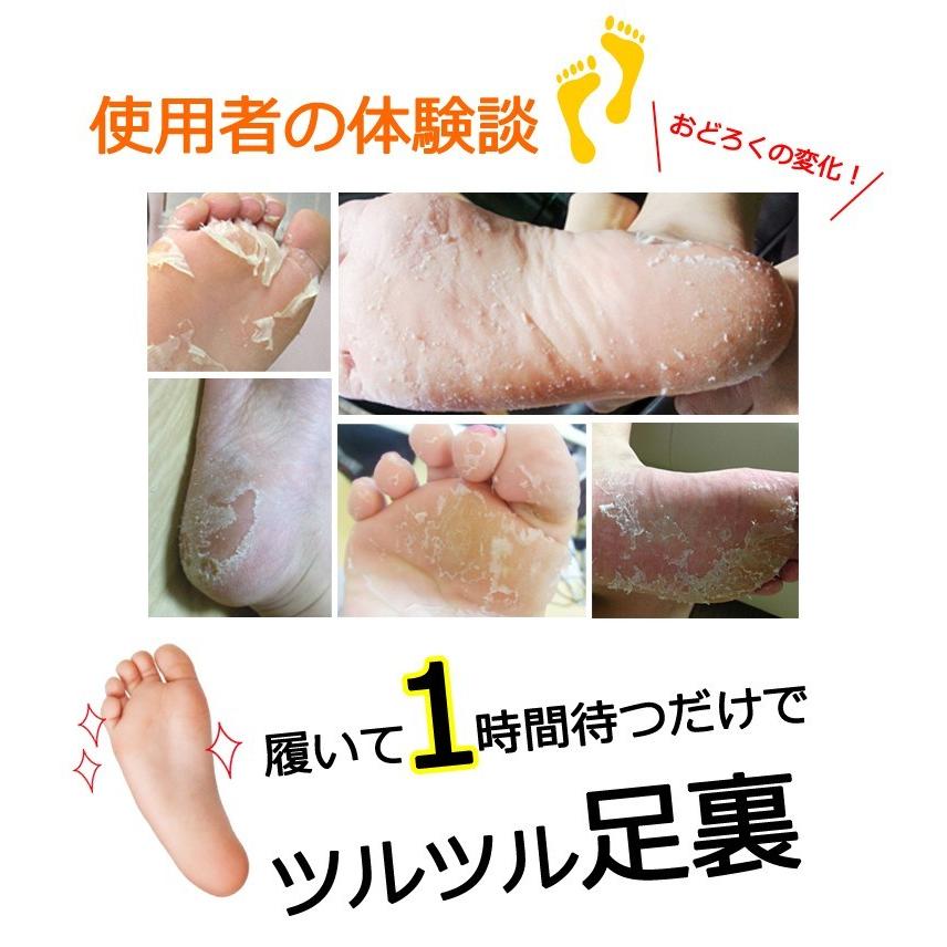 メール便 送料無料 【 Baby Foot 】フットピーリング 足裏 角質ケア【ダッピー】3回分【即日●国内発送】｜coco24｜05