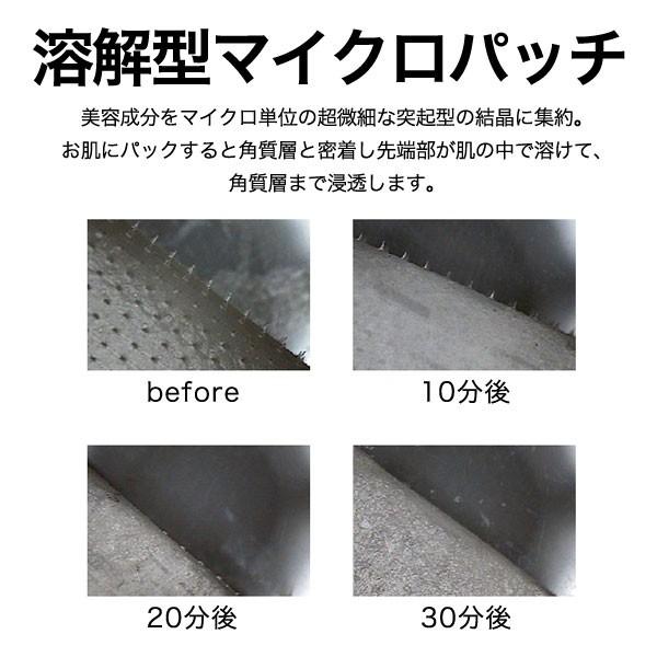 【韓国コスメ】マイクロニードル お得10回分 ザキュア マイクロアイパッチ 目元 口元 【送料無料】ヒアルロン酸直注入 針 THE CURE | ブランド登録なし | 03