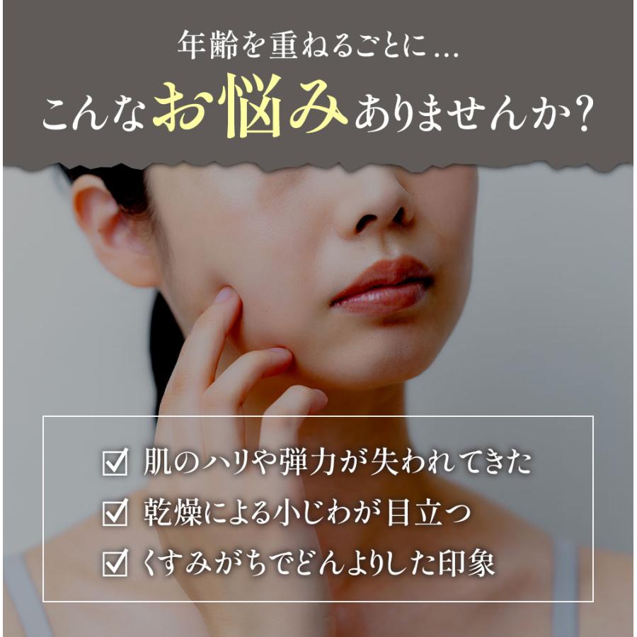 ARES 自由が丘クリニック ステムCエッセンス ローション ヒト幹細胞