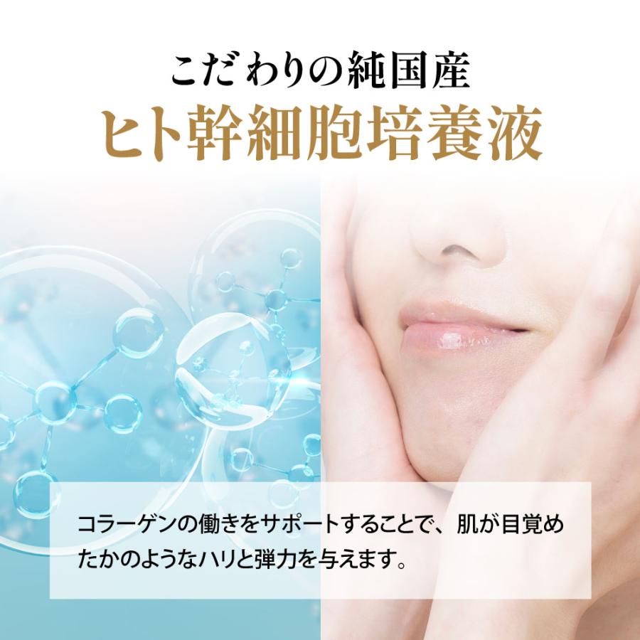 ARES 自由が丘クリニック ステムCエッセンス ローション ヒト幹細胞