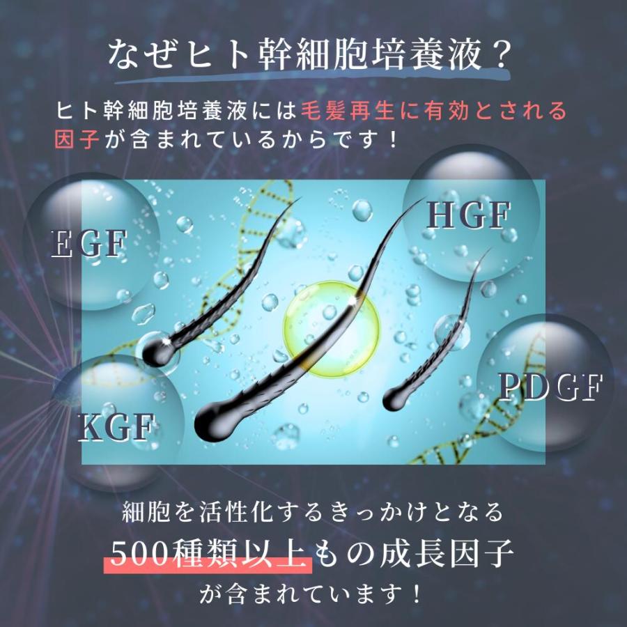 自由が丘クリニック JC スカルプエッセンス アドバンス 頭皮ケア