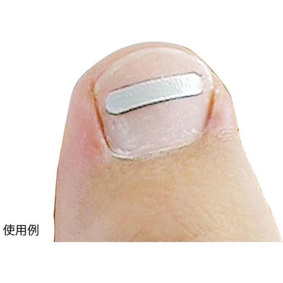 お取り寄せ】アズワン オニクリップ巻き爪ケア スターターセット 爪