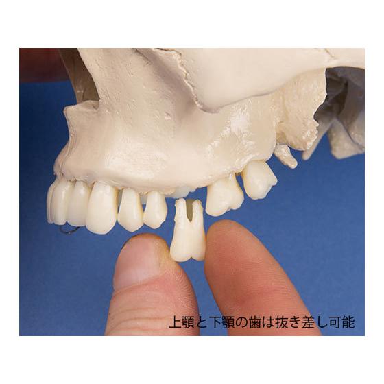 お取り寄せ】Erler-Zimmer 頭蓋骨モデル 歯科用 4513 模型 教育 看護