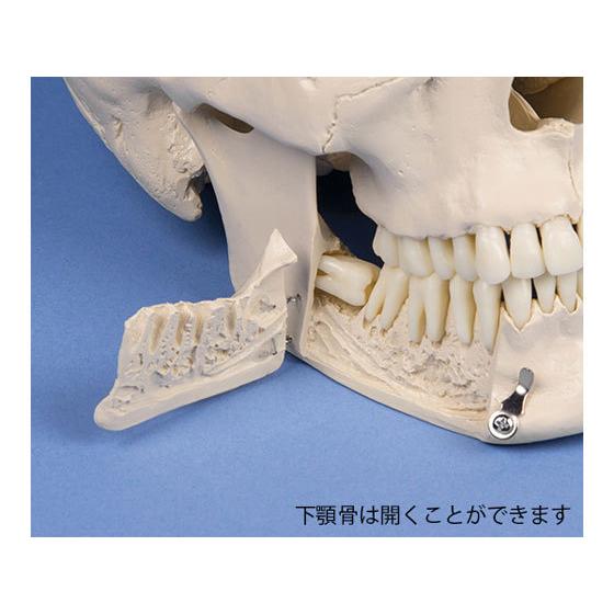 お取り寄せ】Erler-Zimmer 頭蓋骨モデル 歯科用 4513 模型 教育 看護