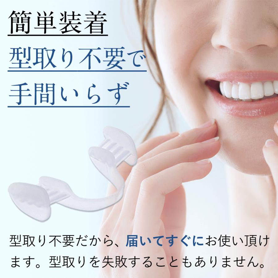 DENTES正規品 歯科医師監修 マウスピース 1箱2個入り ケース付き