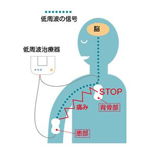 オムロンヘルスケア 低周波治療器 HVF-021-J3W OMRON 持ち運び 家庭用 電池式 スマホ PC コリ 痛み 腕 肩 腰 ふくらはぎ もみ たたき 揉み 運動 ケア HVF021J3W|の画像