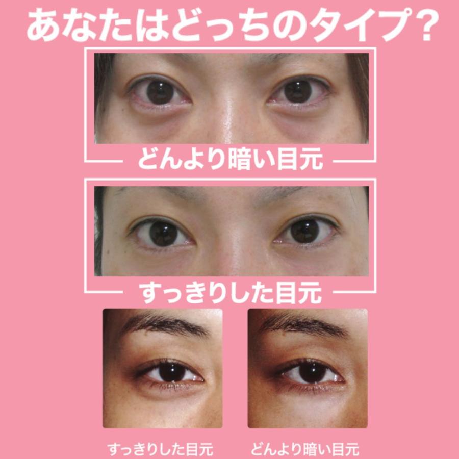 お値下げしました！目元のクマ、たるみに。美顔器リスタートアイ 楽天市場】目元美顔器 リスタートアイ ／ 目元 目元ケア EMS