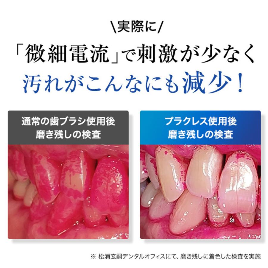 公式ショップ】歯ブラシ ハブラシ 電子歯ブラシ プラクレス 公式ショップ】歯ブラシ ハブラシ 電子歯ブラシ プラクレス