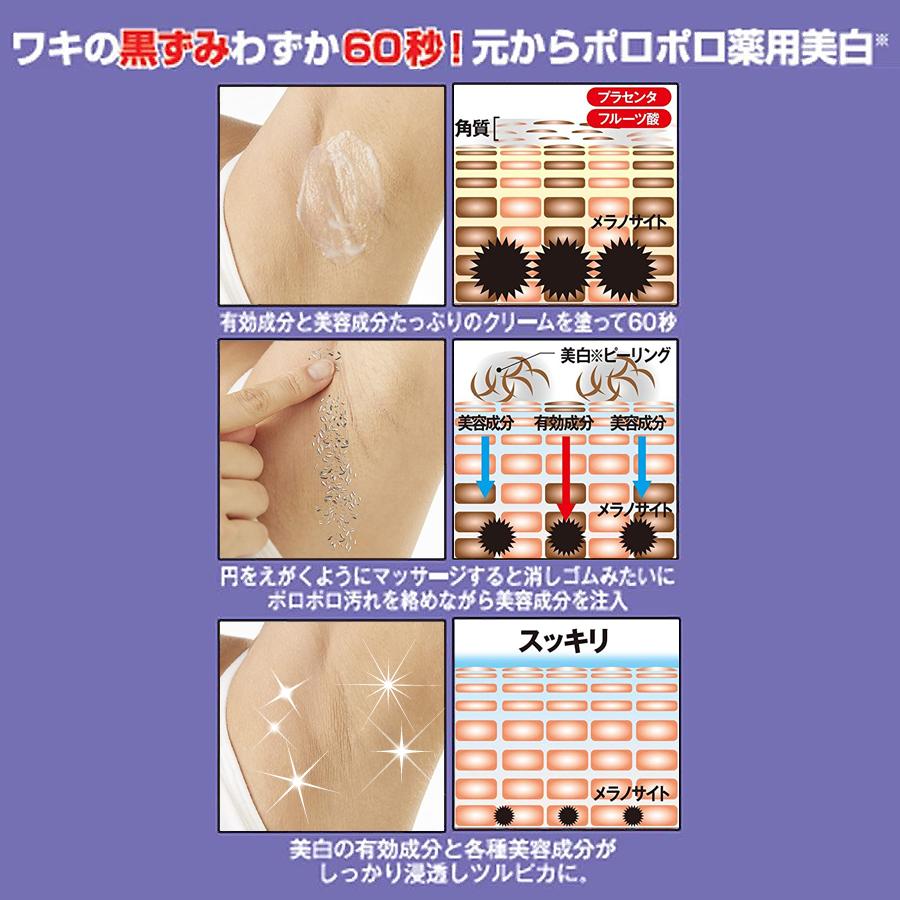 直輸入品激安 2個セット 脇の黒ずみ 脇 黒ずみ 解消 クリーム デリケートゾーン わき 臭い 対策 角質 ピーリング 口コミ 薬用ワキレーゼ スムースピーリングクリーム g