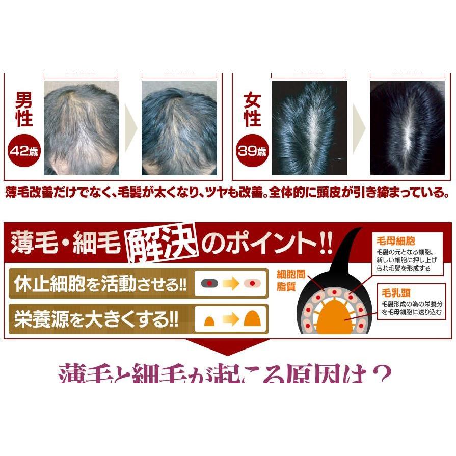 Re;Mou リモウスカルプローション 120mL(男女兼用) : cosme通販 - 通販 