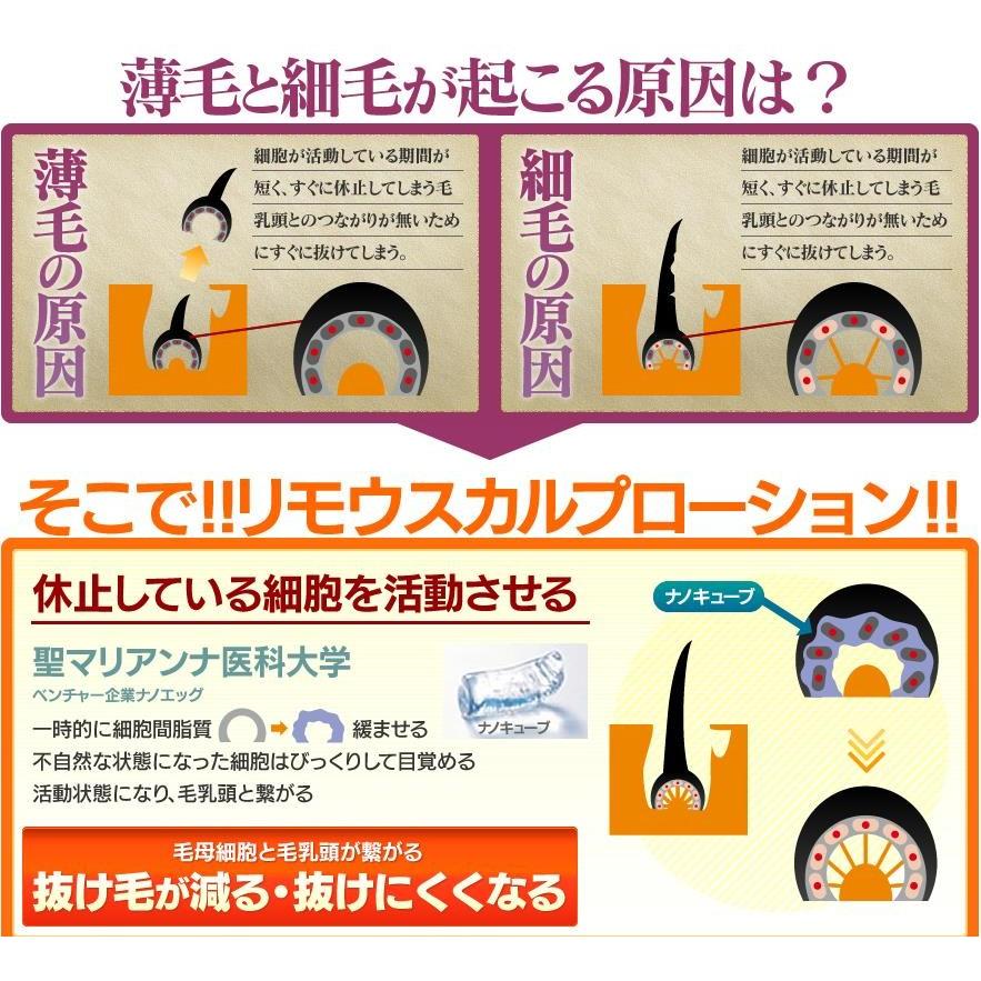 Re;Mou リモウスカルプローション 120mL(男女兼用) : cosme通販 - 通販 