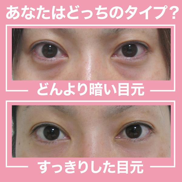 オムニ アイスラッククロフィートネオ 1セット｜cosmecom｜04