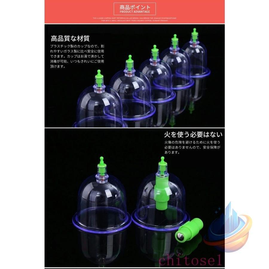 吸玉 カッピング 吸い玉 12個セット 吸引器 *吸玉 マッサージ カップ
