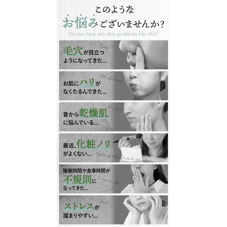 CBD スキンクリーム カンナビジオール 高配合 CBDクリーム くすみ 乾燥