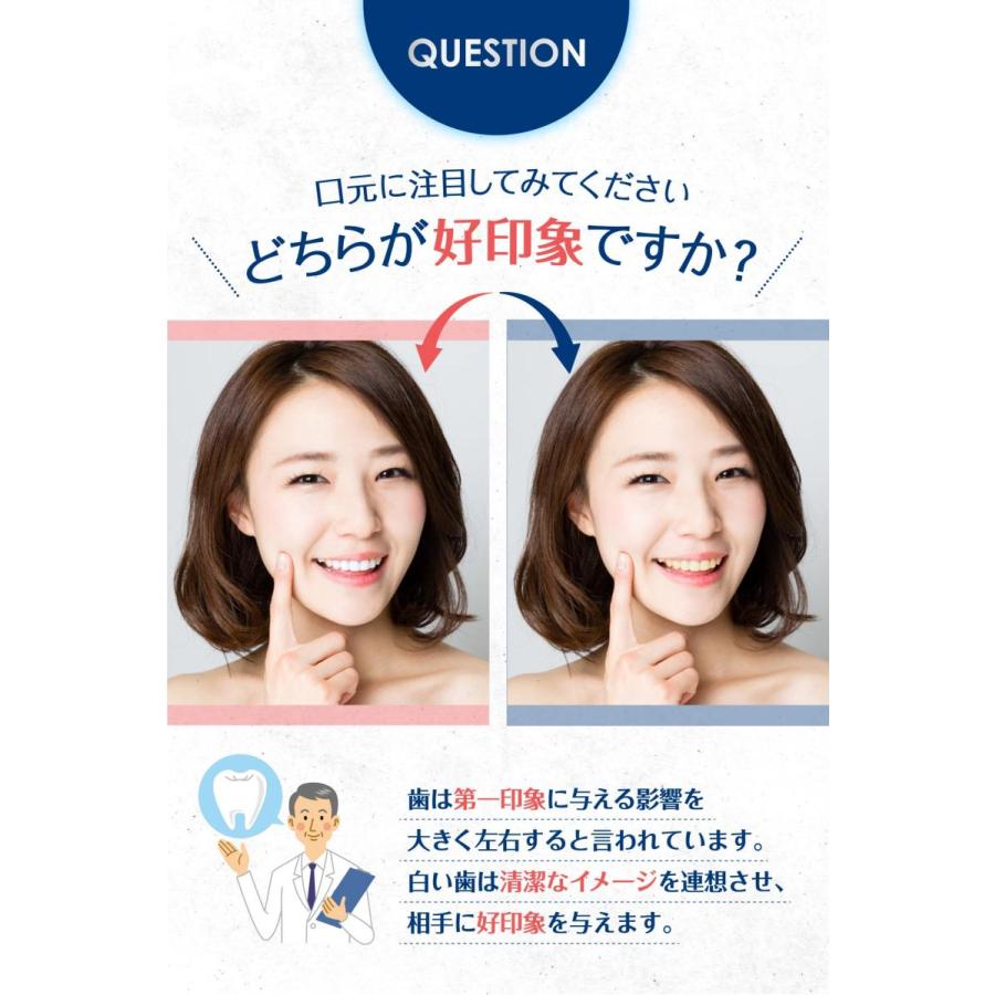 現役歯科医師と共同開発 /ホワイトニング 歯磨き粉 ホーム