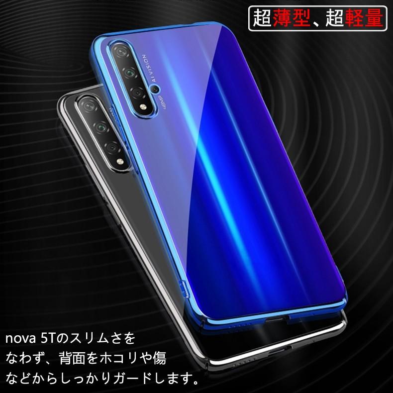 (送料無料 メール便発送) HUAWEI nova 5T 裏面用ケース メッキ加工 TPU 全6色 (nova5T SIMフリー ソフトタイプ カバー Case Cover) | HUAWEI nova | 03