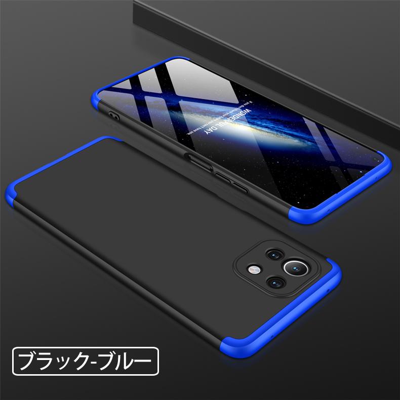 Mi (送料無料) 11 Lite 5G 360°フルカバーケース 薄型 超軽量