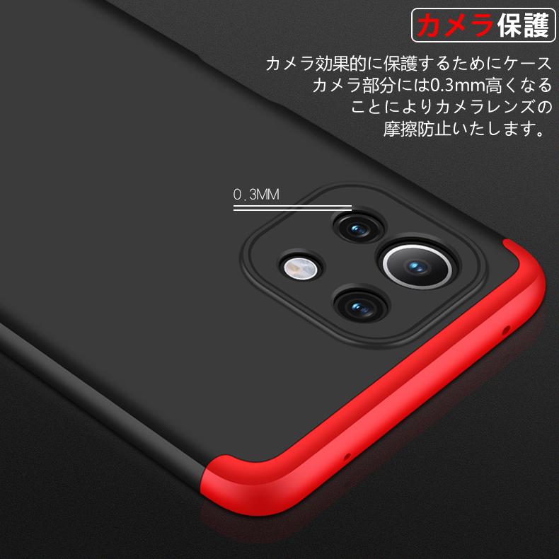 Mi (送料無料) 11 Lite 5G 360°フルカバーケース 薄型 超軽量