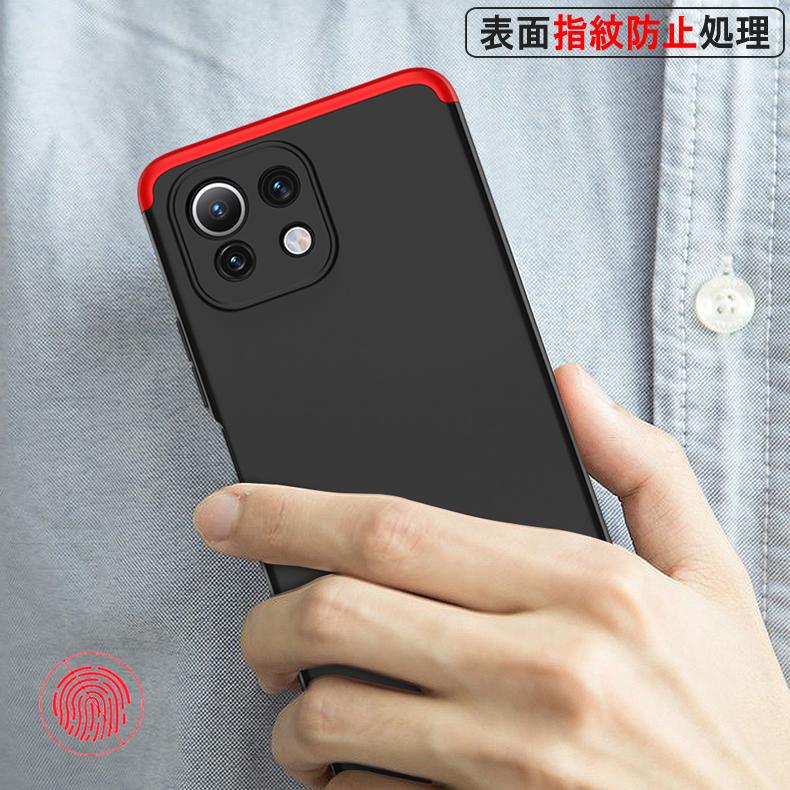 Mi (送料無料) 11 Lite 5G 360°フルカバーケース 薄型 超軽量