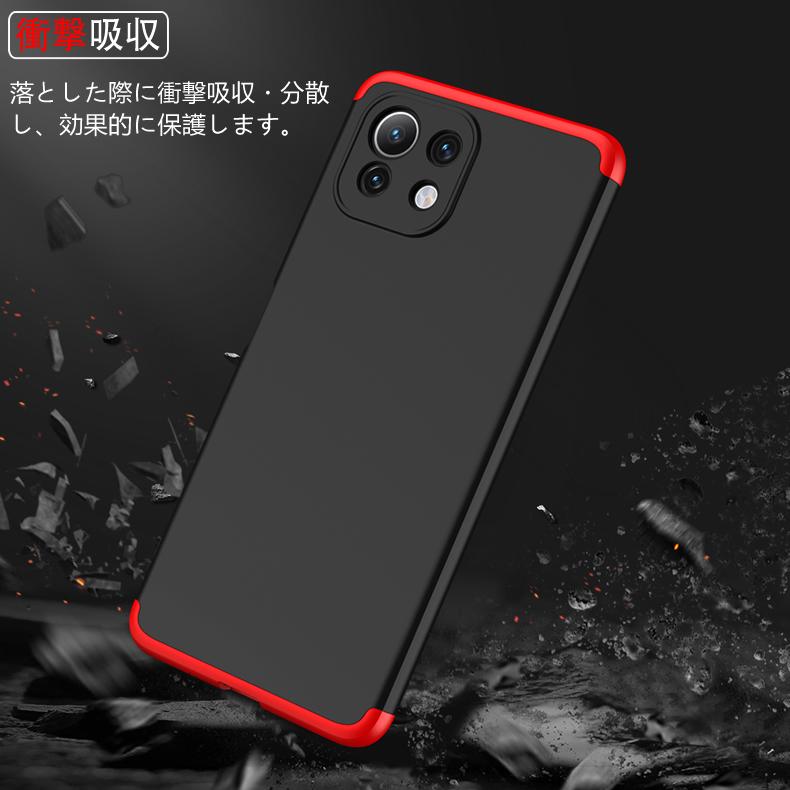 Xiaomi Mi 11 Lite 5G ケース付き　美品 SIMフリー Xiaomi Mi 11 Lite 5G ケース付き 美品 SIMフリー Amazon.com