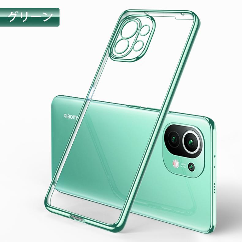 Mi (送料無料) 11 Lite 5G 背面用ケース メッキ加工 TPU 全8色 (Xiaomi 