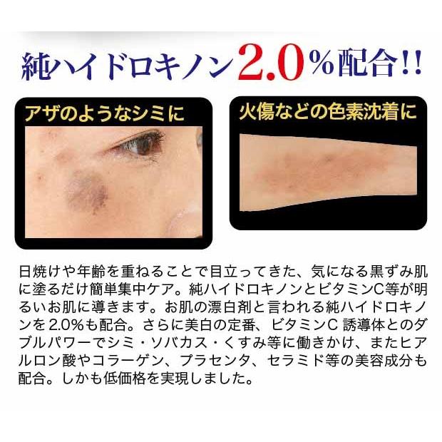 セレブライト スキンピュアクリーム！色素沈着 ハイドロキノン