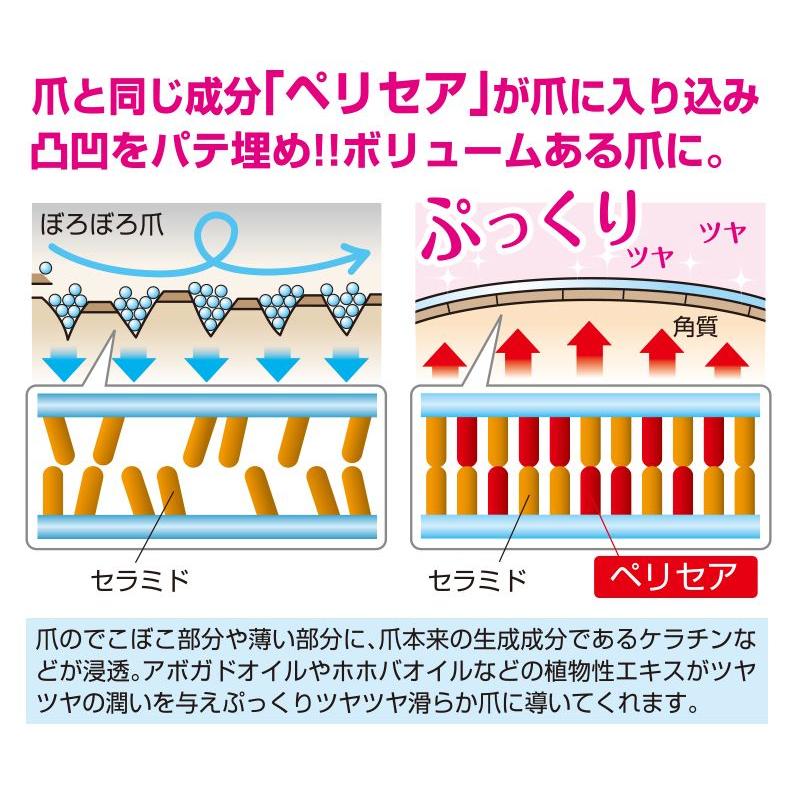 爪に栄養を与え爪を太らせる美容液 ネイルセラム ココ ボロボロで隠しがちな爪から 魅せられるぷっくり爪に Gl0018 クロノスショップ 通販 Yahoo ショッピング