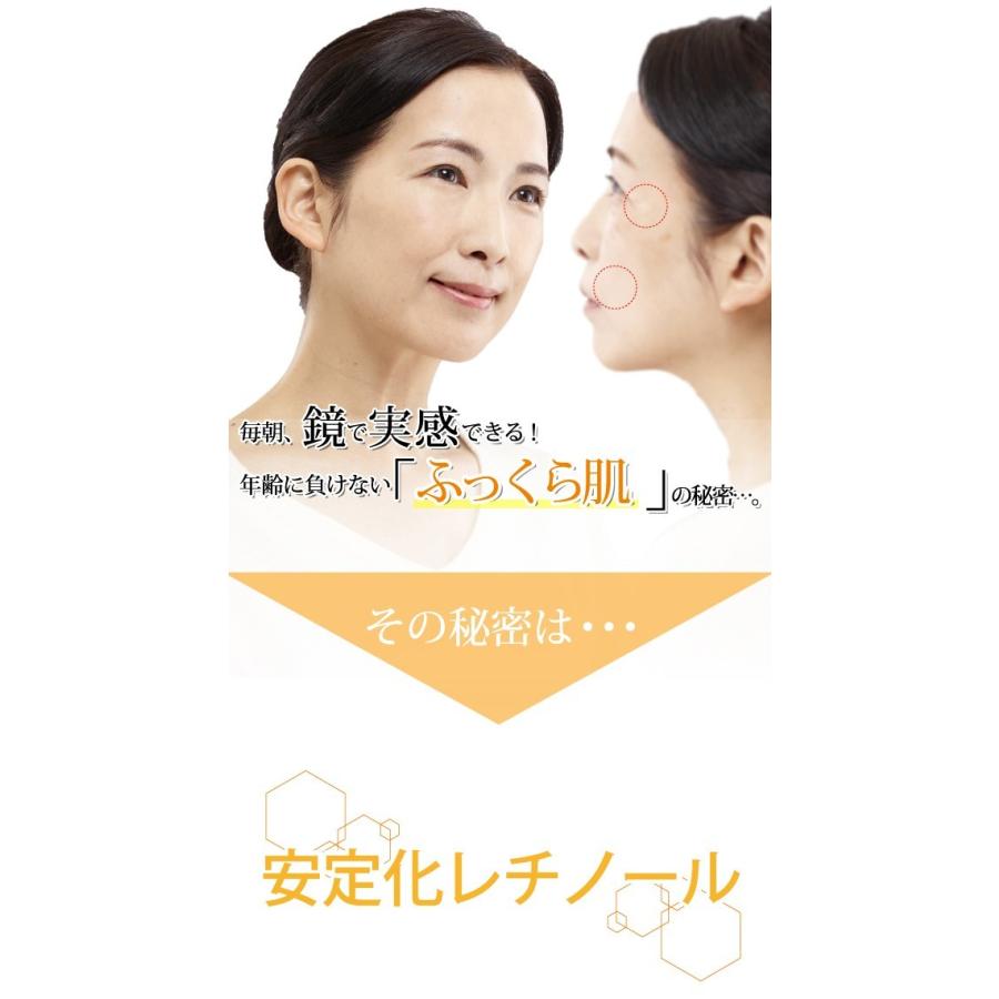 レチロンA しわ対策 年齢に負けない「ふっくら肌」シワ伸ばし たるみ 集中ケア 顔のシワとりシワ消し|cronos-shop|03
