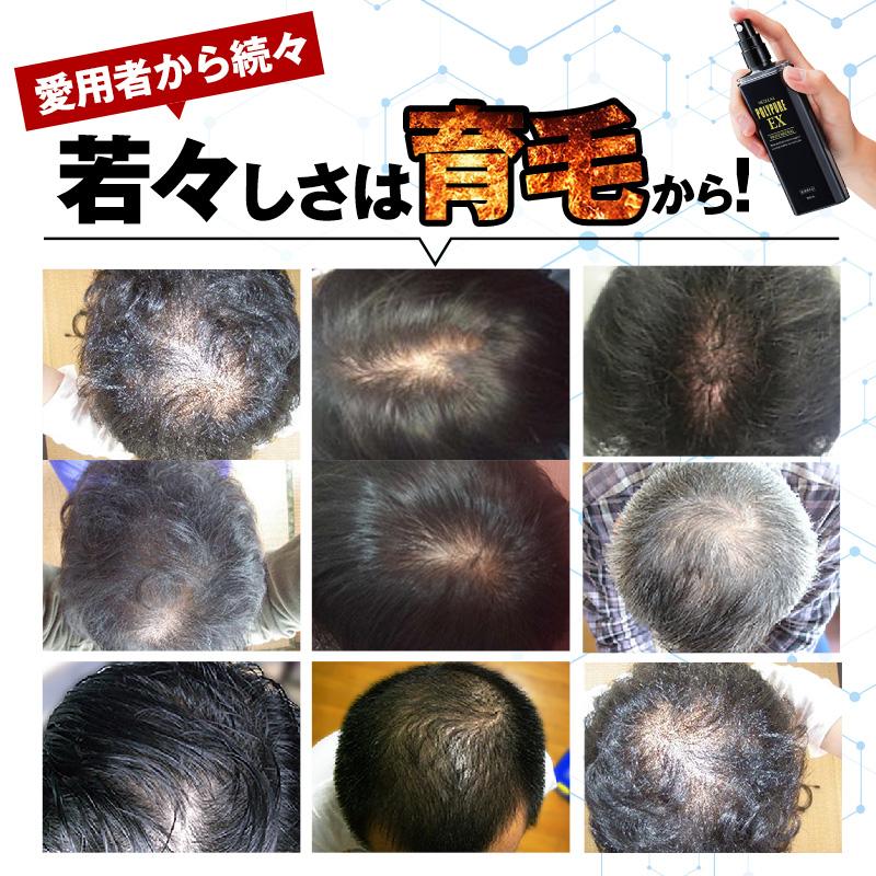 ポリピュア 公式 ポリピュアEX 120mL×3本 育毛剤 メンズ 女性用 ポリピュア 公式 ポリピュアEX 120mL×3本 育毛剤 メンズ 女性用