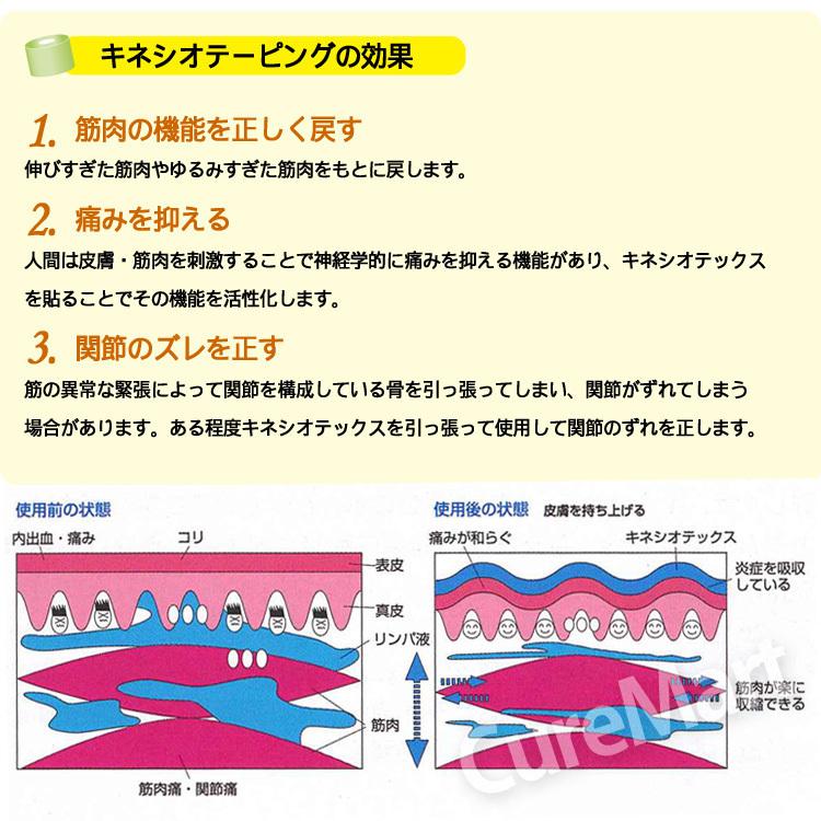 キネシオテーピング キネシオ テックス クラシック ブルー 50mm×長さ4m