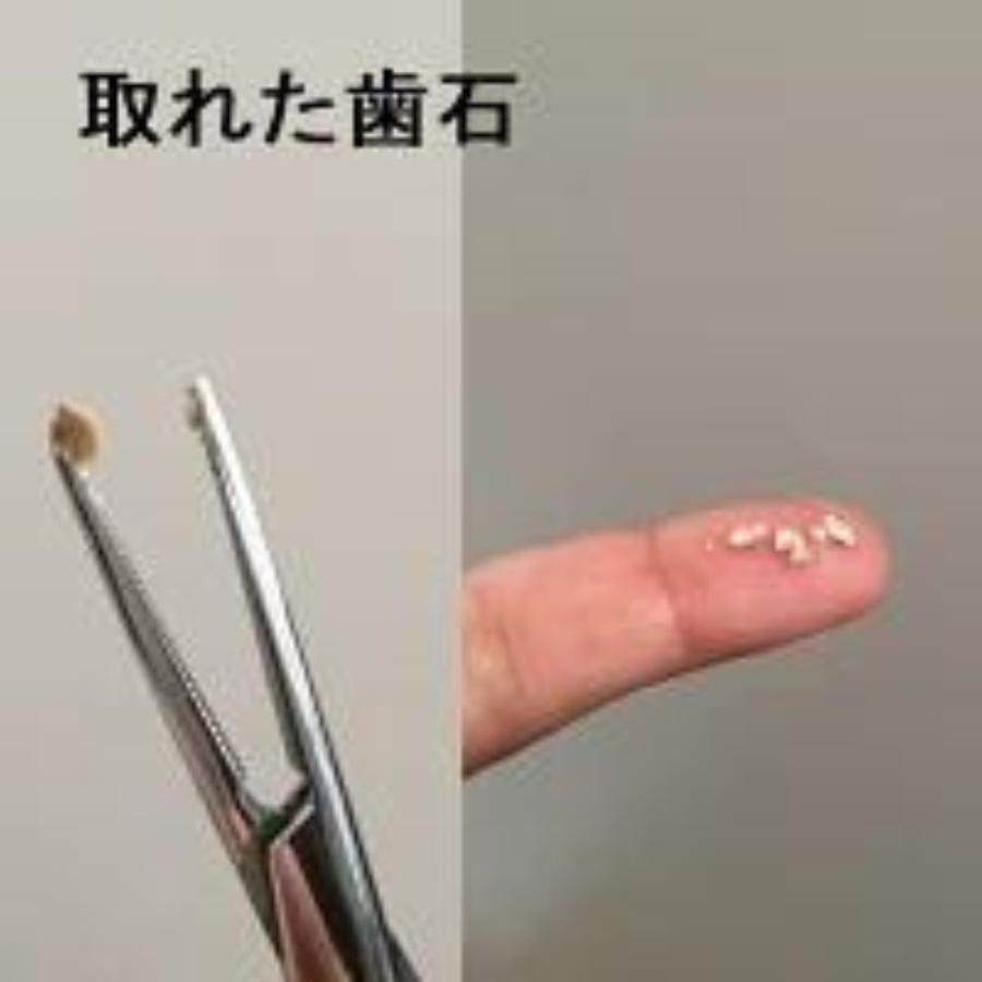 犬 猫 歯石取り 歯石予防 歯磨き アルマダイアモンド２本セット 犬 歯石 歯磨き 歯石除去 口臭 毎日の歯磨き 予防 歯石取り 歯みがきジェル |  | 04