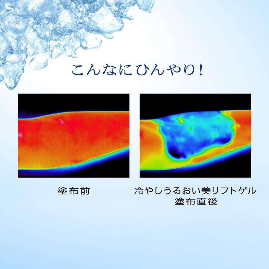 PRIOR 【数量限定】資生堂 プリオール 薬用 冷やしうるおい美