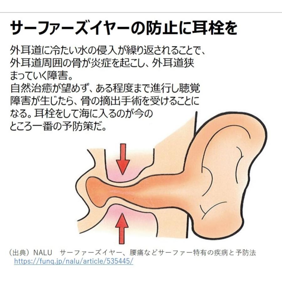 耳栓 ミニイヤースーツ Ear Suits mini 音が聞こえる耳栓 女性 子供 サイズ 水上スポーツのために開発 サーフィン | ブランド登録なし | 04