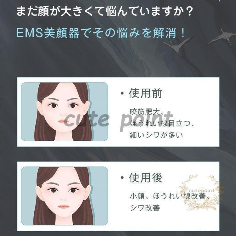 EMS美顔器 リフトアップ 引き締め たるみ改善 シワ改善 フェイスライン