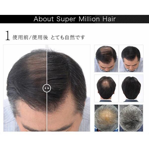 57%OFF!】 スーパーミリオンヘアー３０ｇブラックorダークブラウン３個