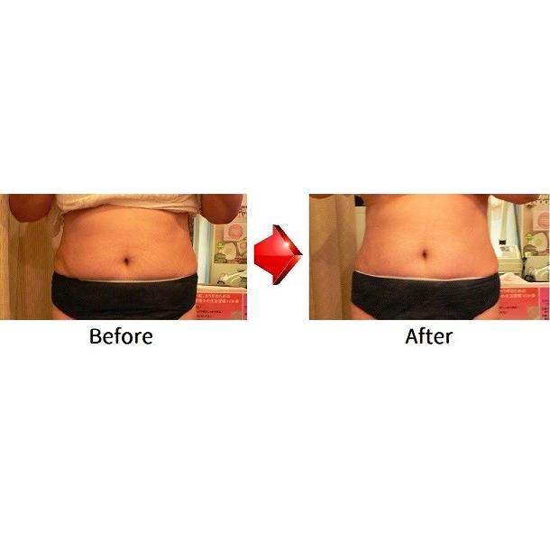 脂肪燃焼クリーム　テクニカルプロTechnical PRO　130ml 脂肪燃焼クリーム テクニカルプロTechnical PRO 130ml