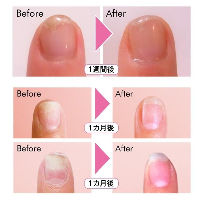 ２年連続 モンドセレクション銀賞 受賞 ネイルセラム ルーロ 無香料 ローズ Md ハン市場 通販 Yahoo ショッピング