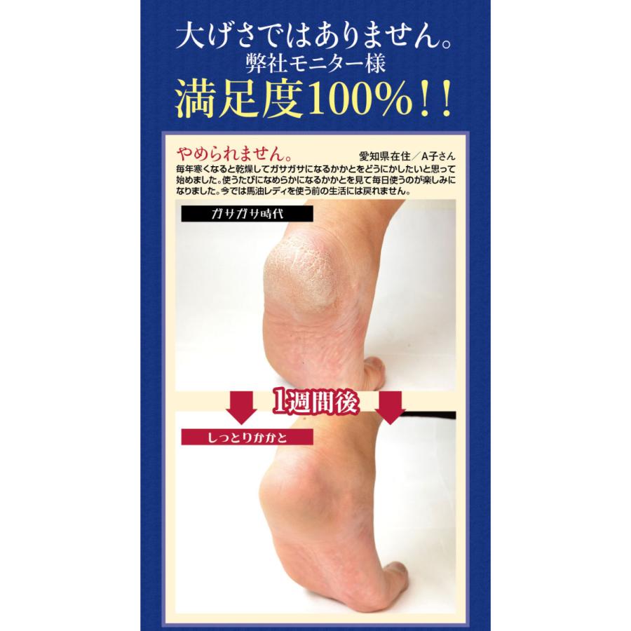 【ポイント１５倍】かかと専用クリーム 薬用こってり 【馬油レディ】医薬部外品 【内容量 約３０g】踵 カカト ガサガサ かかとの悩みを解決するために作りました｜cyoju｜05