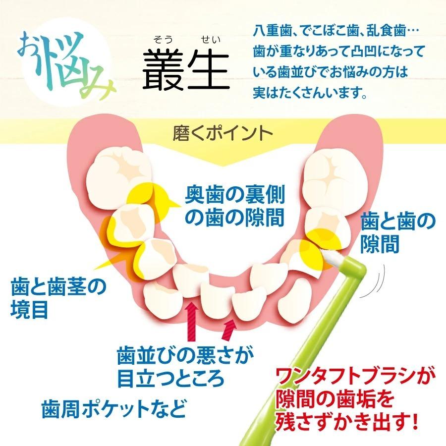 Ciメディカル 歯ブラシ ペングリップワンタフト MSやややわらかめ 4本