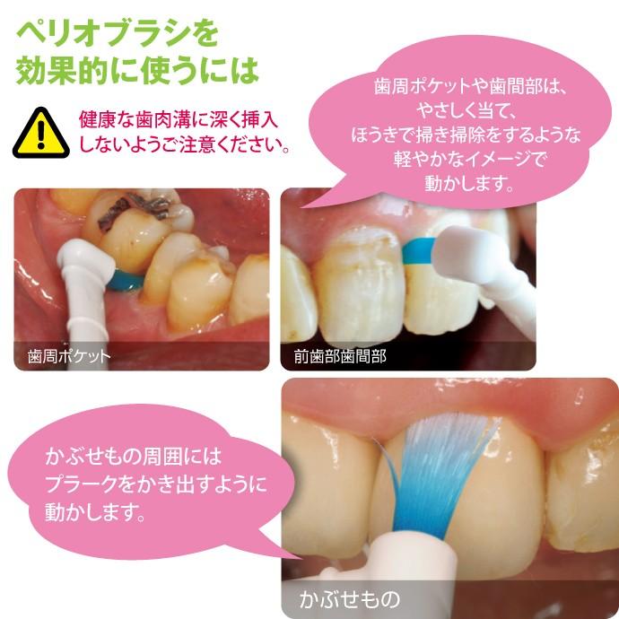 GC（ジーシー） 歯ブラシ ルシェロ ペリオブラシ（ハンドル付）NO.1T