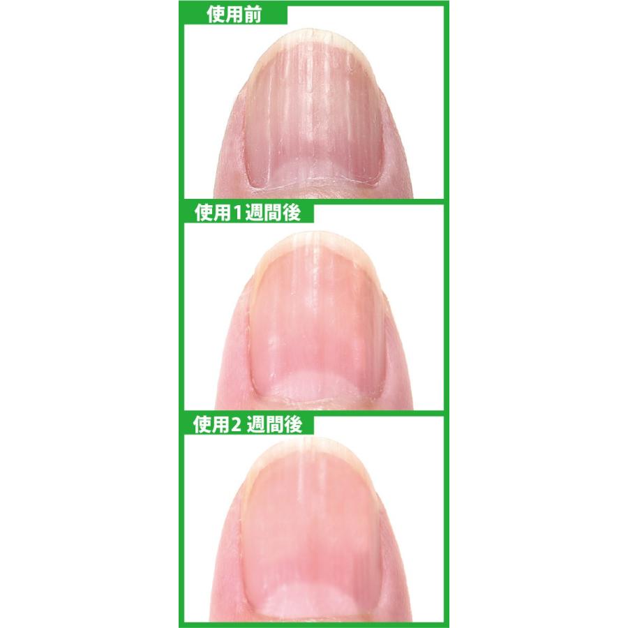 ネイル美容液 キュレ-Qure-(6ml) 1本 可能(メール便20点まで)｜d-fit｜03