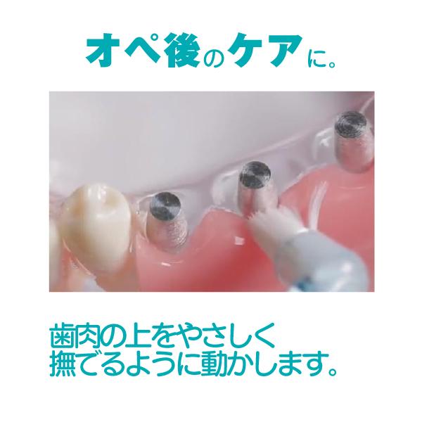 オーラルインプラントロジー 今月の新商品 －その月に発売された新商品を随時ご案内致します