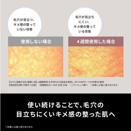 ★Panasonic / パナソニック バイタリフト RF EX EH-SR86-T [ブラウン]【美容器具・美容家電】【送料無料】_5