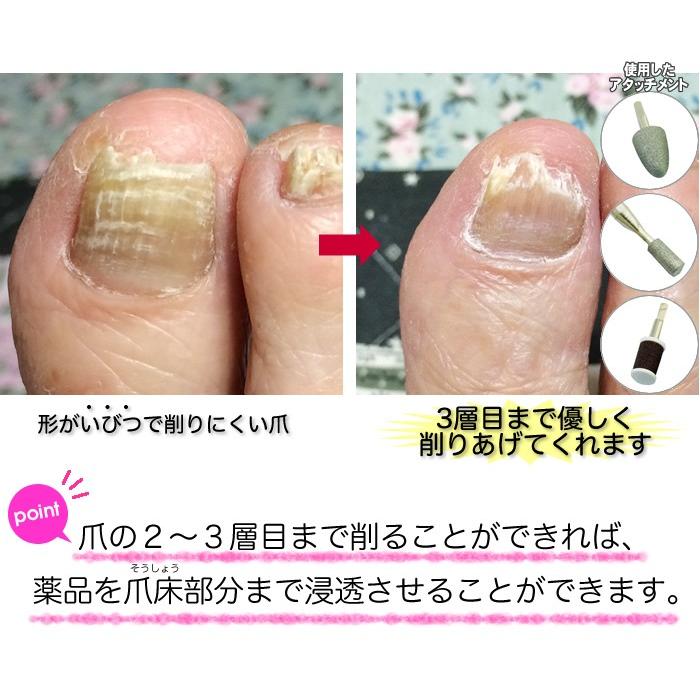 ＴＶや雑誌でも注目！フットケアの本格派マシン マニクイックエイト（8種類のアタッチメント付） マニクイック8 maniquick ペディキュア プレゼント ギフト 女性 |  | 02