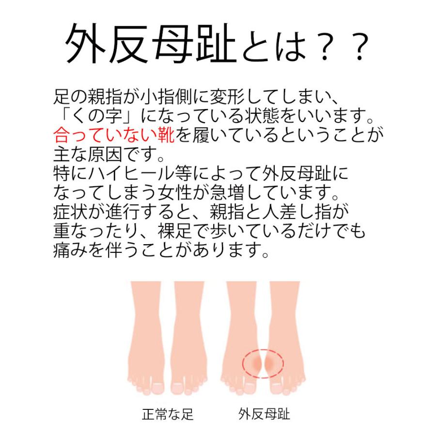 外反母趾やわらかパッド2足組 外反母趾矯正 足指サポーター 男女兼用 シリコンパッド 男女兼用 2足組4個入り｜dami｜02