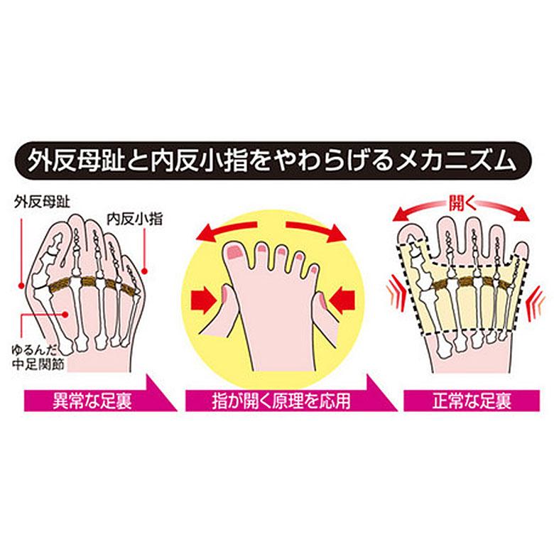 外反母趾 内反小指サポーター  外反母趾 内反小趾 サポーター 矯正 薄手 目立たない 外反母指 矯正 カサハラ 笠原 足裏のバランスを整えるカサハラレッスン |  | 03